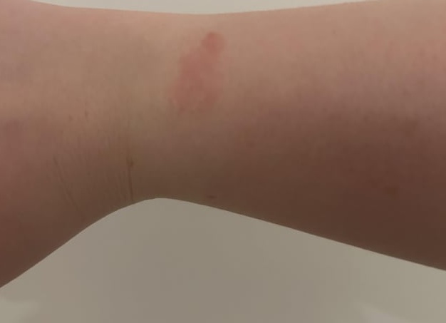 Что такое ЭДС реакции? Что такое стандартный электродный потенциал и как его можно определить экспериментально?